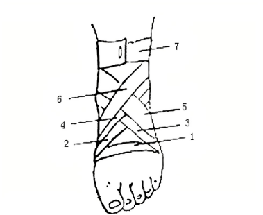 关节八字形怎么绑 膝关节八字绷带的绑法图片